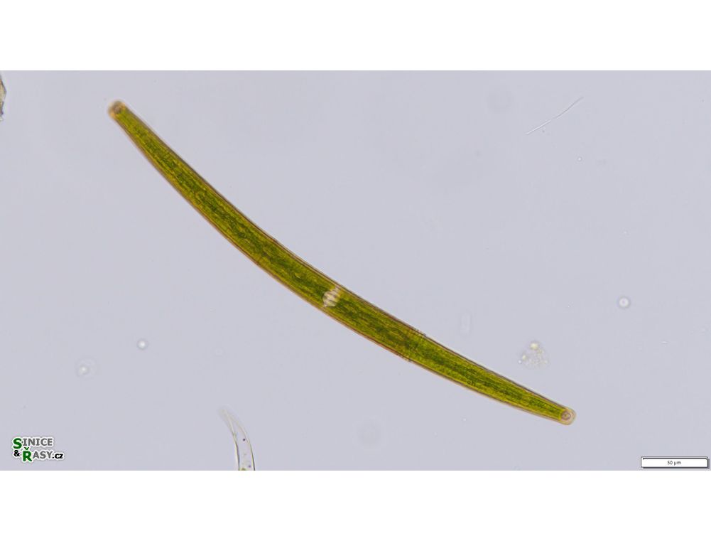 Closterium angustatum