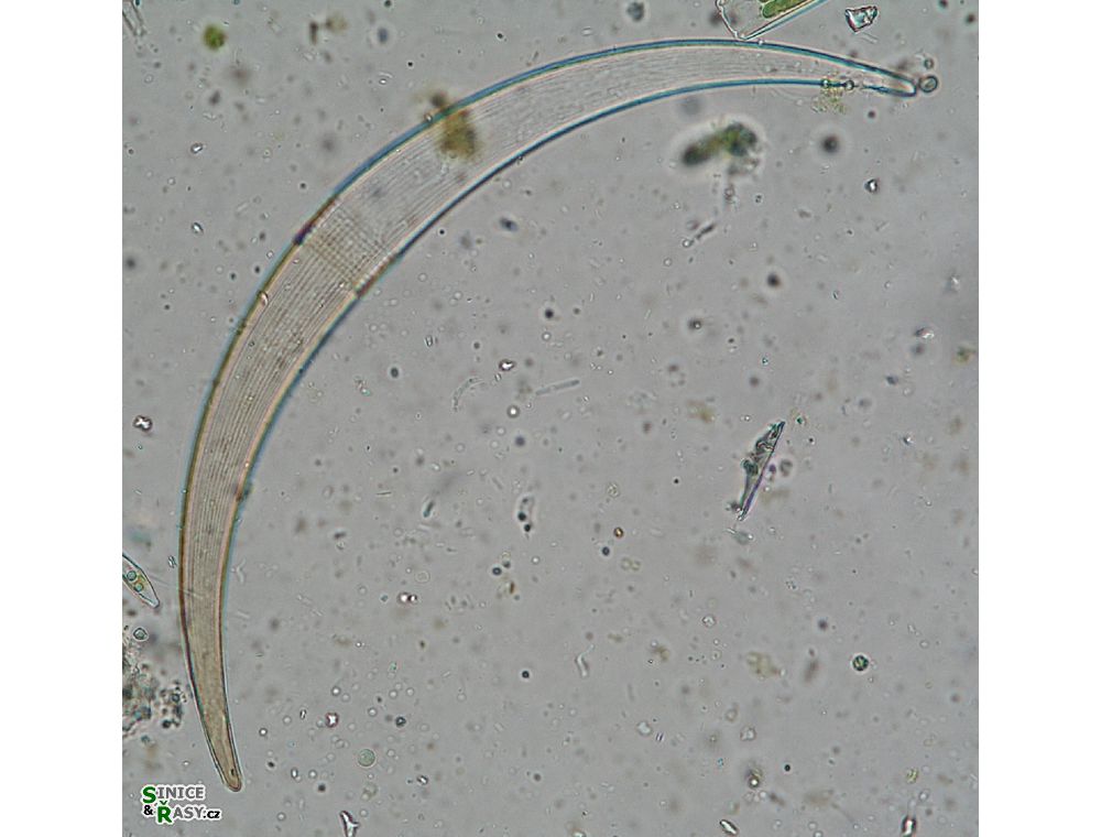 Closterium archerianum