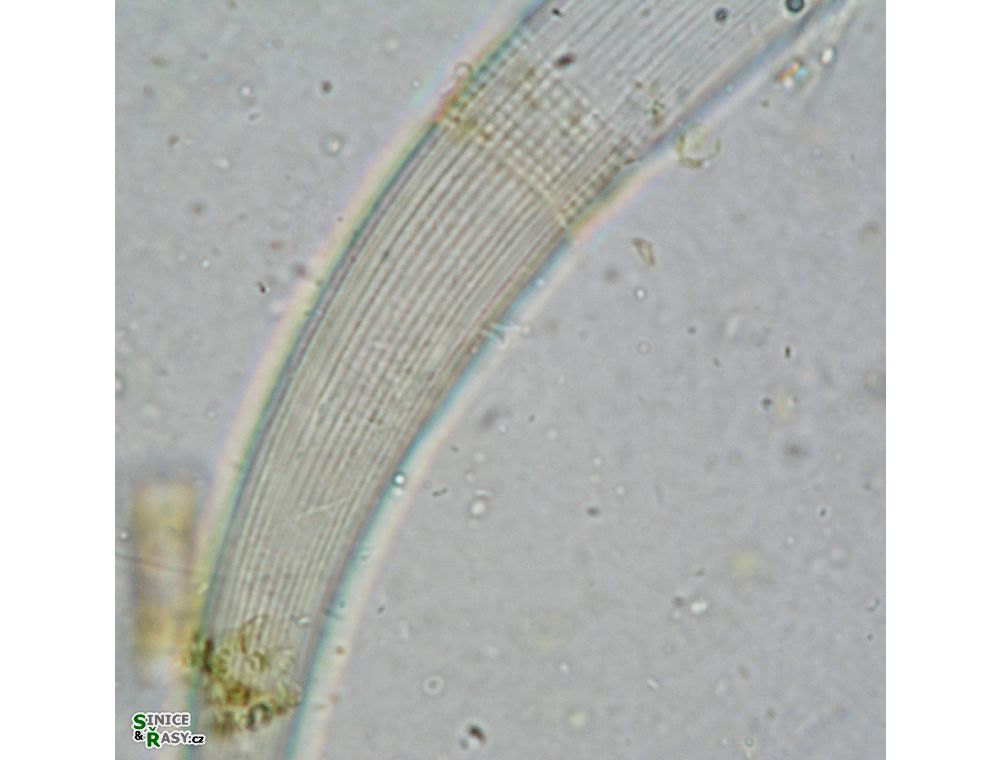 Closterium archerianum