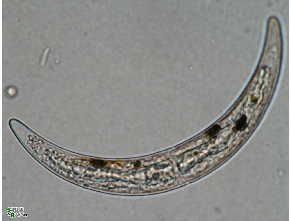 Closterium archerianum
