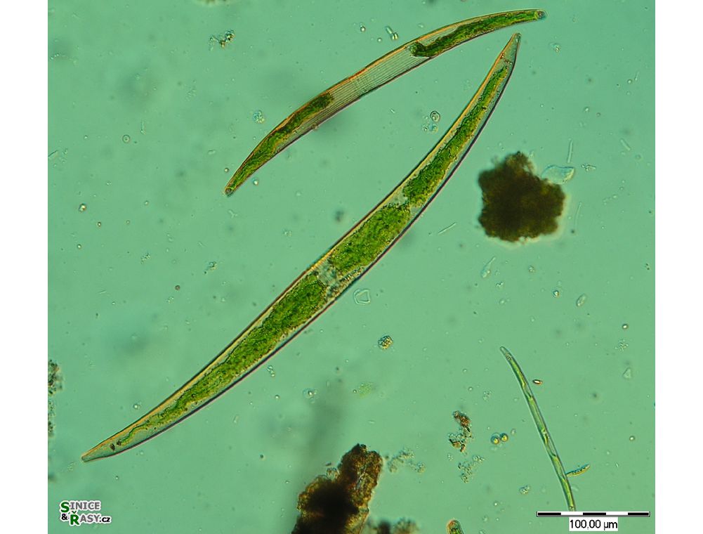 Closterium attenuatum