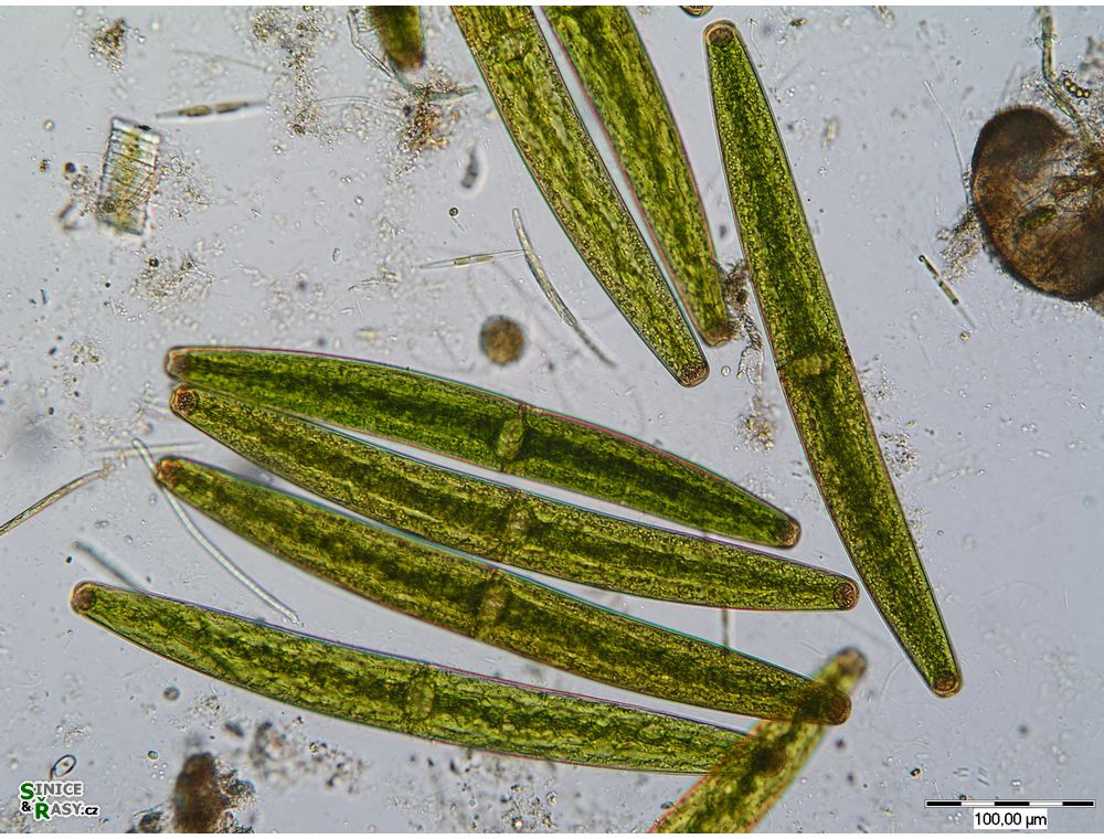 Closterium baillyanum