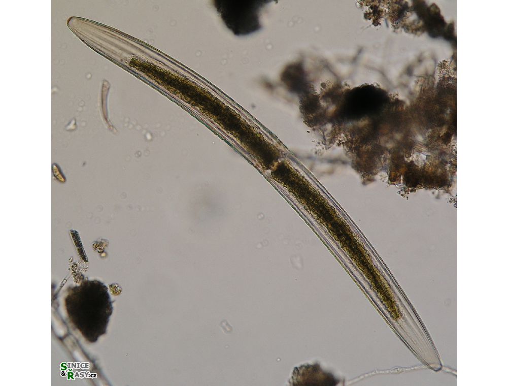 Closterium braunii