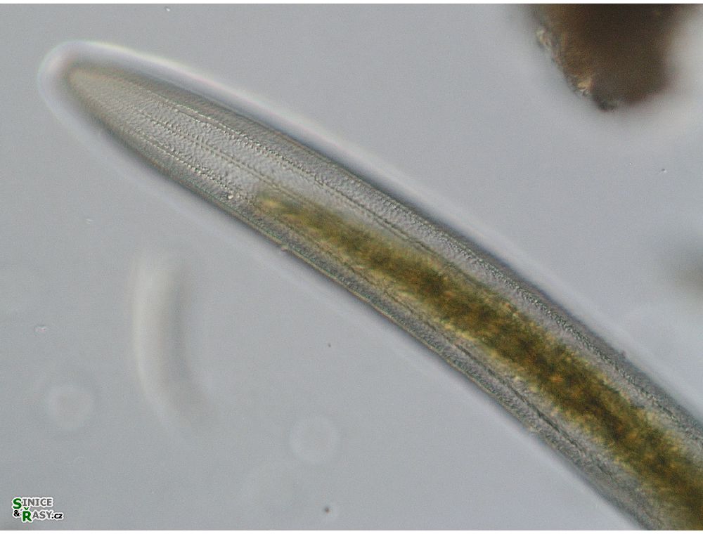 Closterium braunii