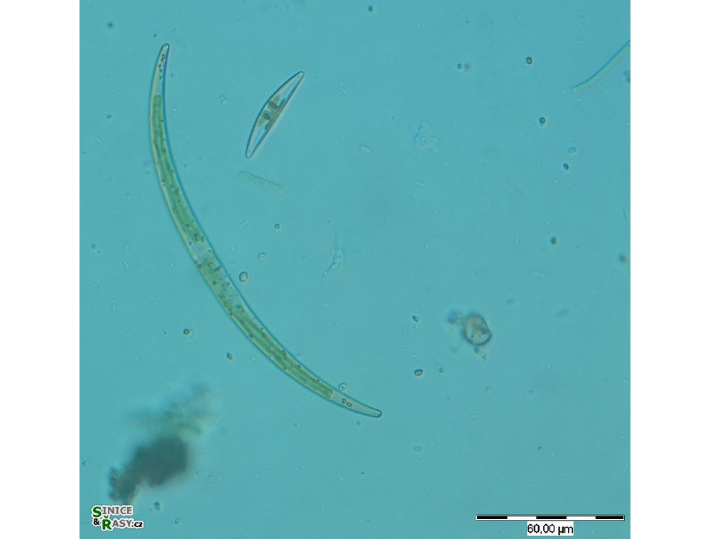 Closterium calosporum