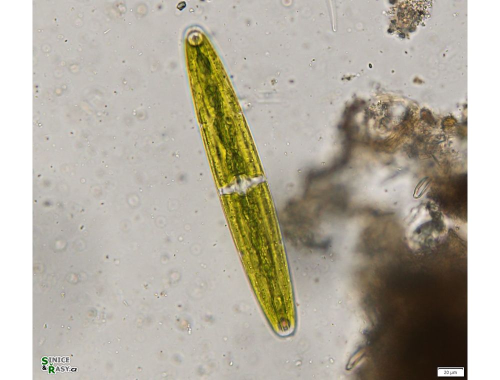 Closterium closterioides