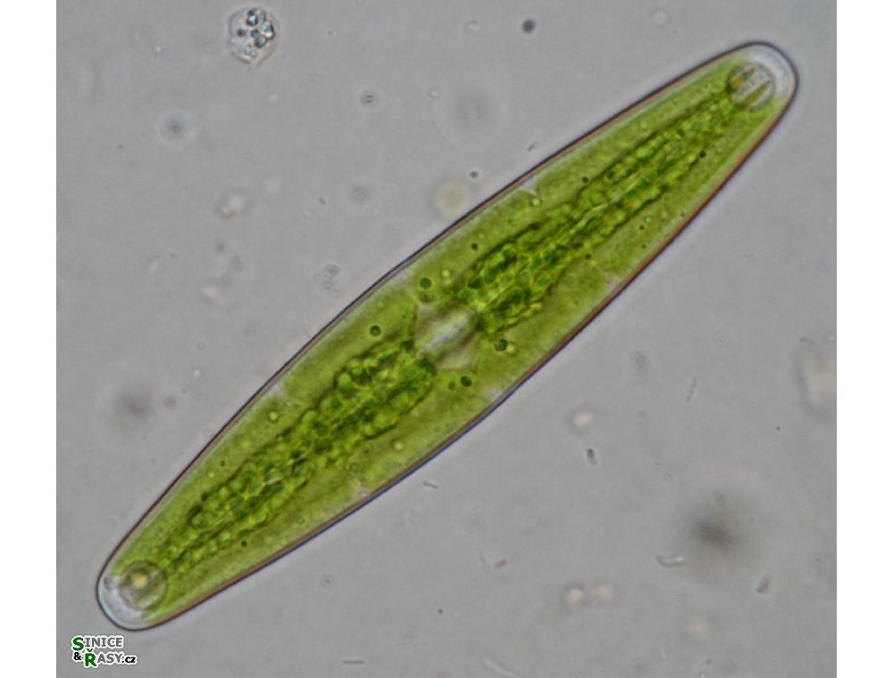 Closterium closterioides