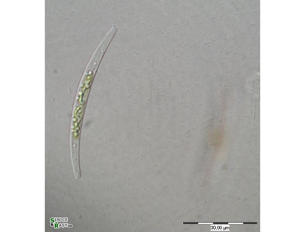 Closterium cornu