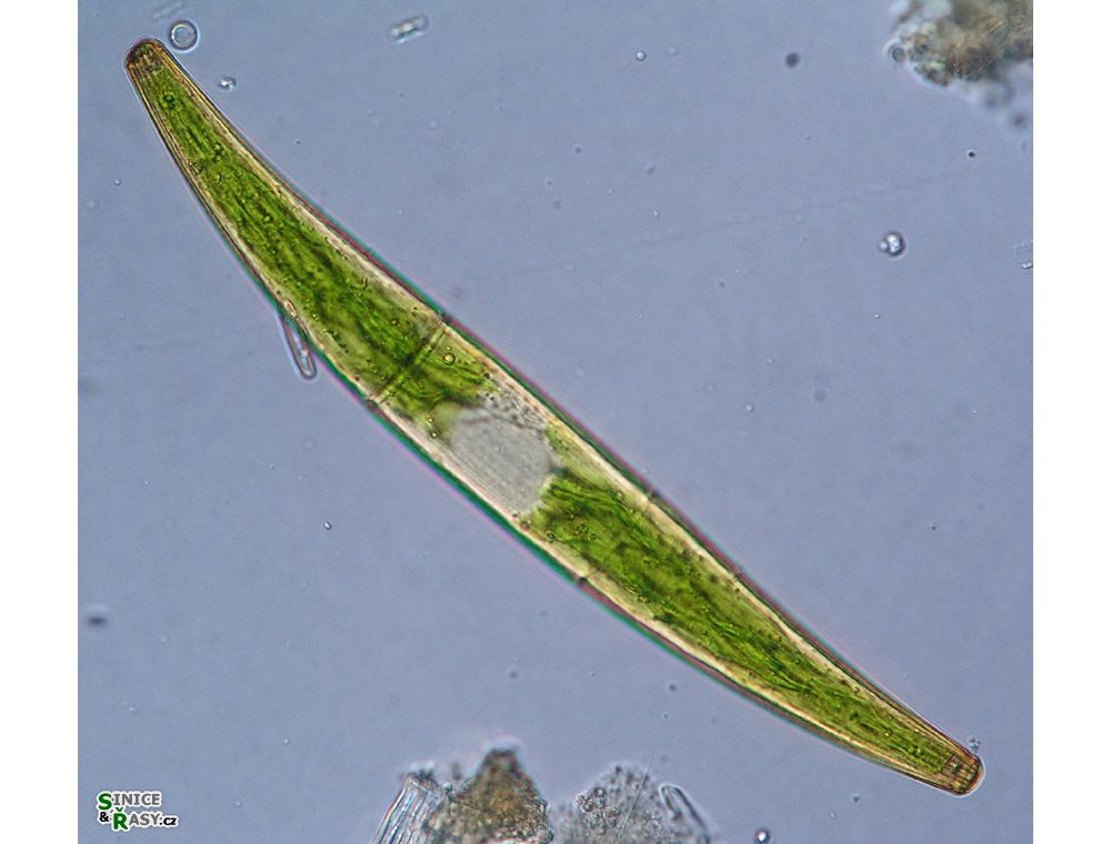 Closterium costatum