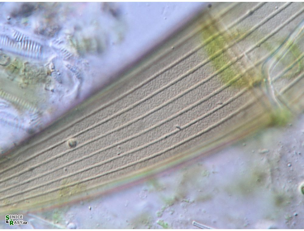Closterium costatum