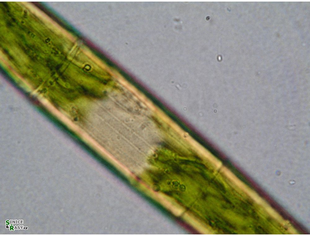 Closterium costatum