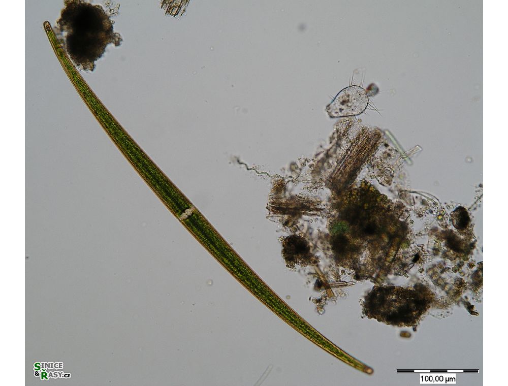 Closterium delpontei