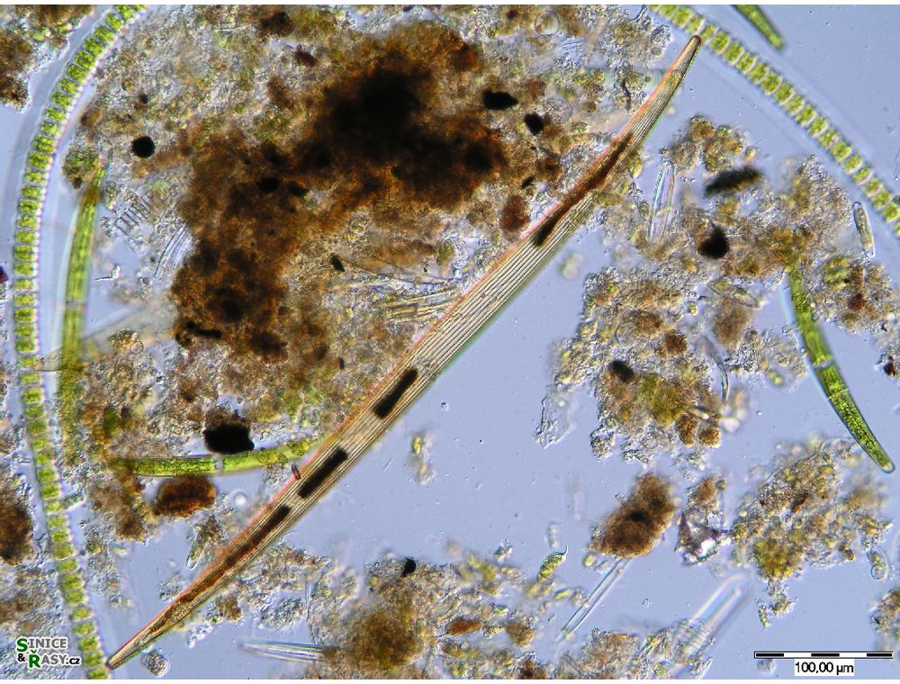 Closterium delpontei