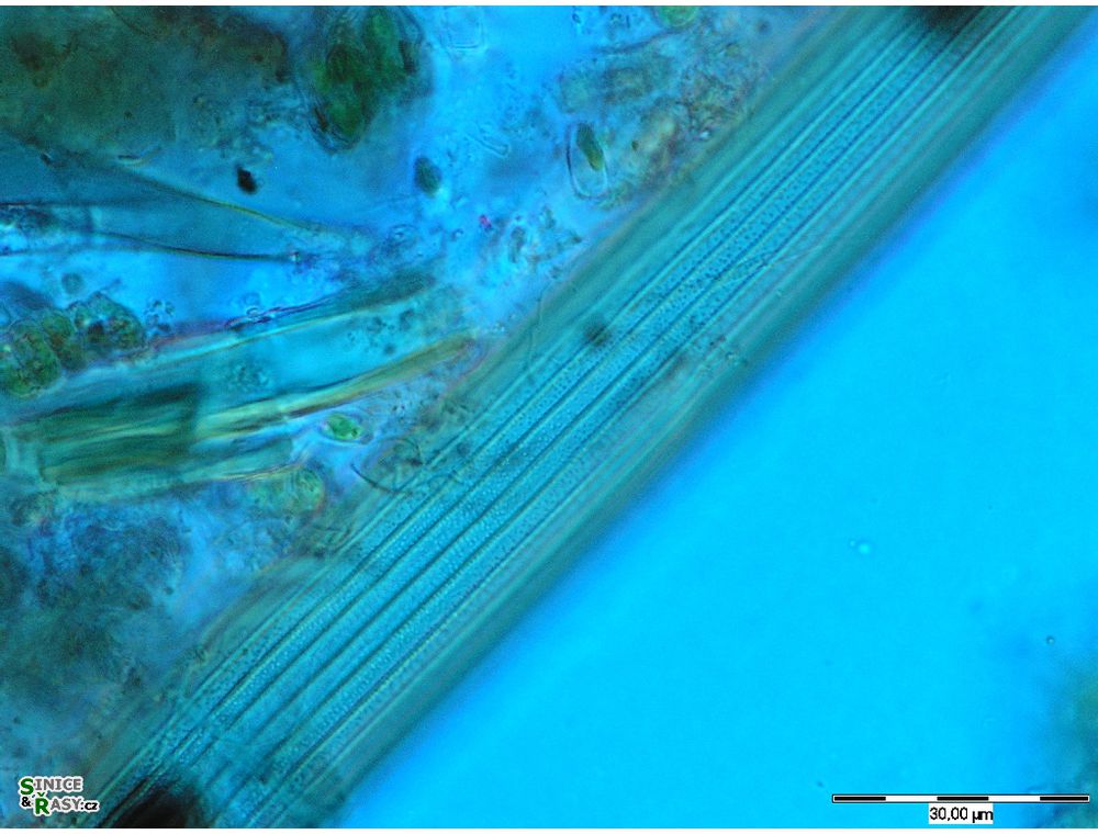 Closterium delpontei
