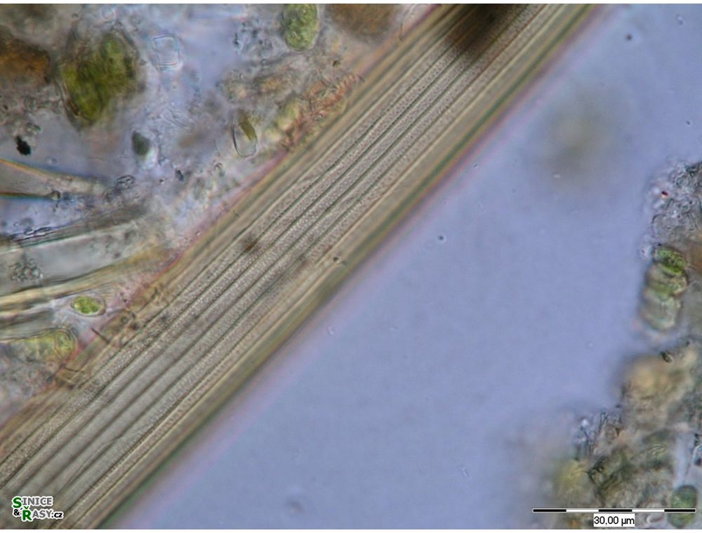 Closterium delpontei