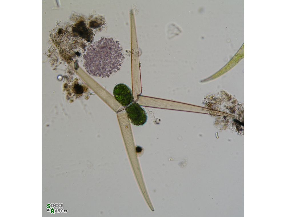 Closterium delpontei