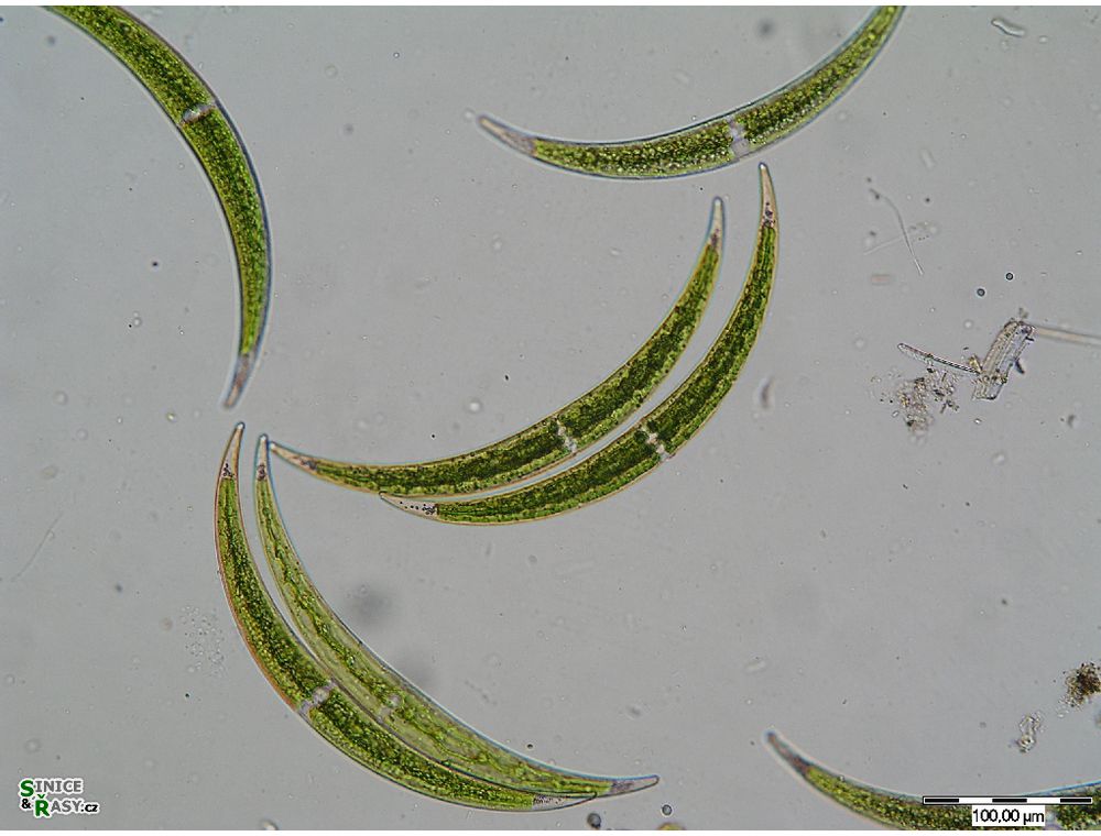 Closterium dianae