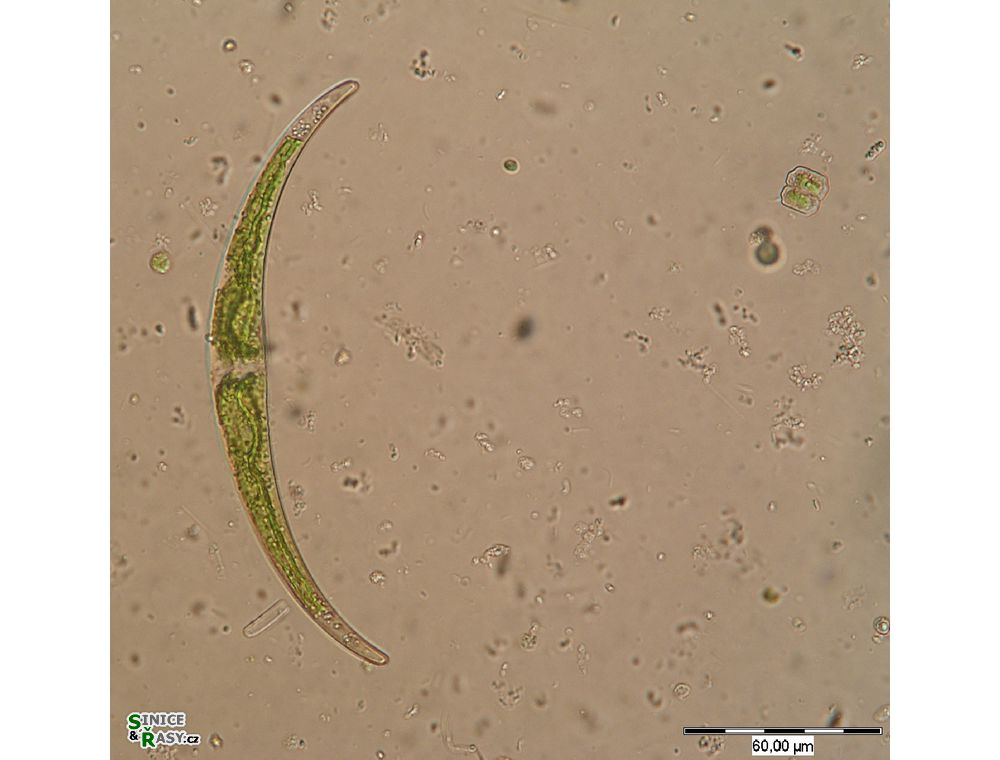 Closterium dianae