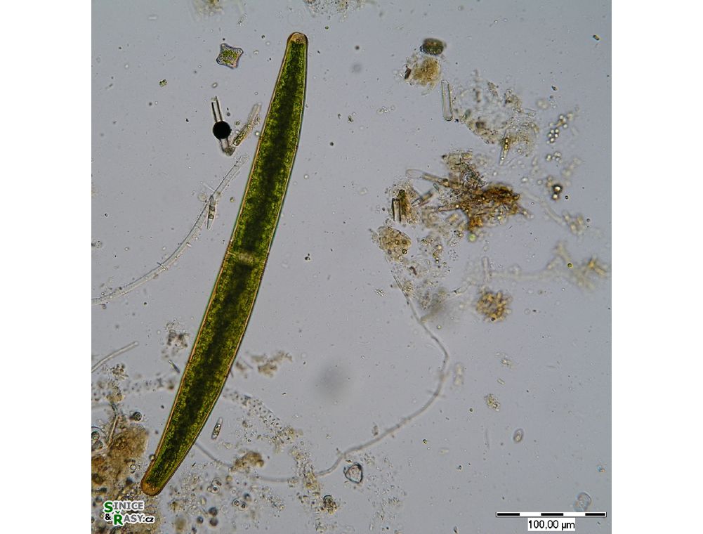 Closterium didymotocum