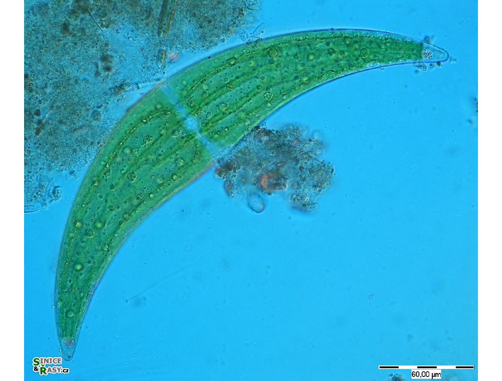 Closterium ehrenbergii