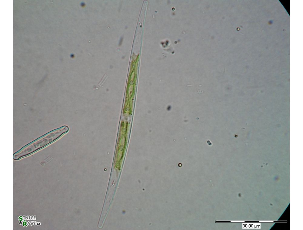 Closterium idiosporum