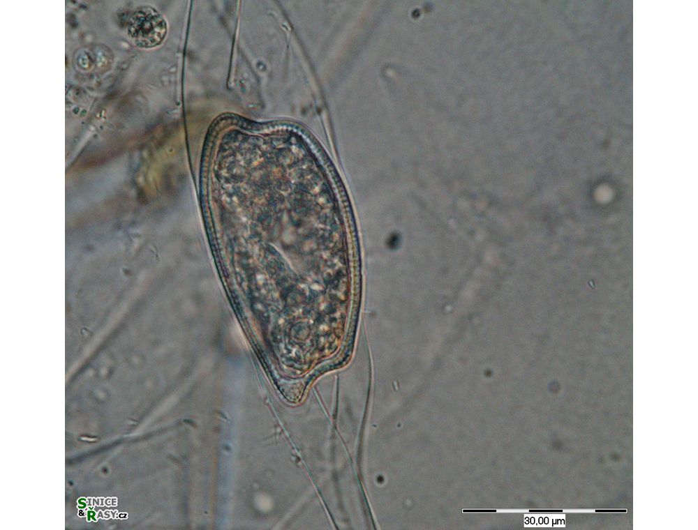 Closterium idiosporum