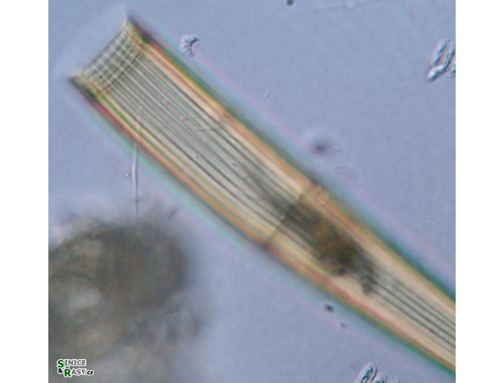 Closterium intermedium