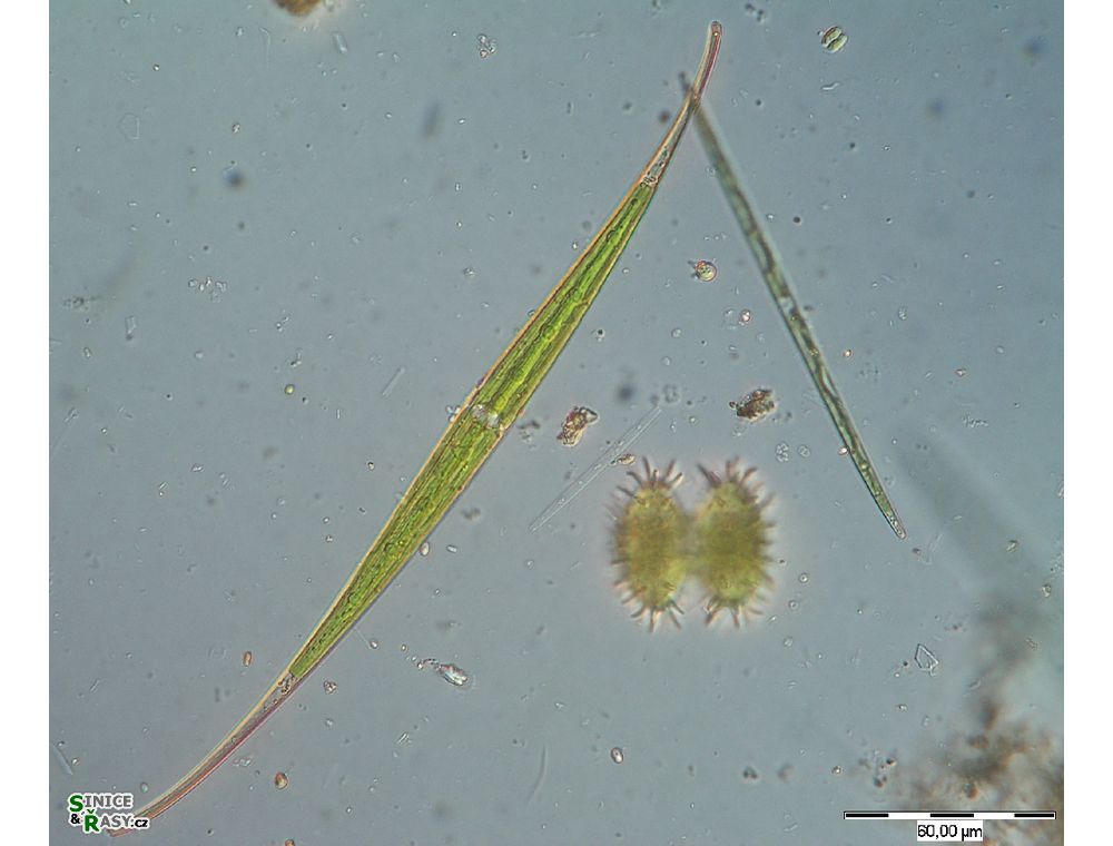 Closterium kuetzingii