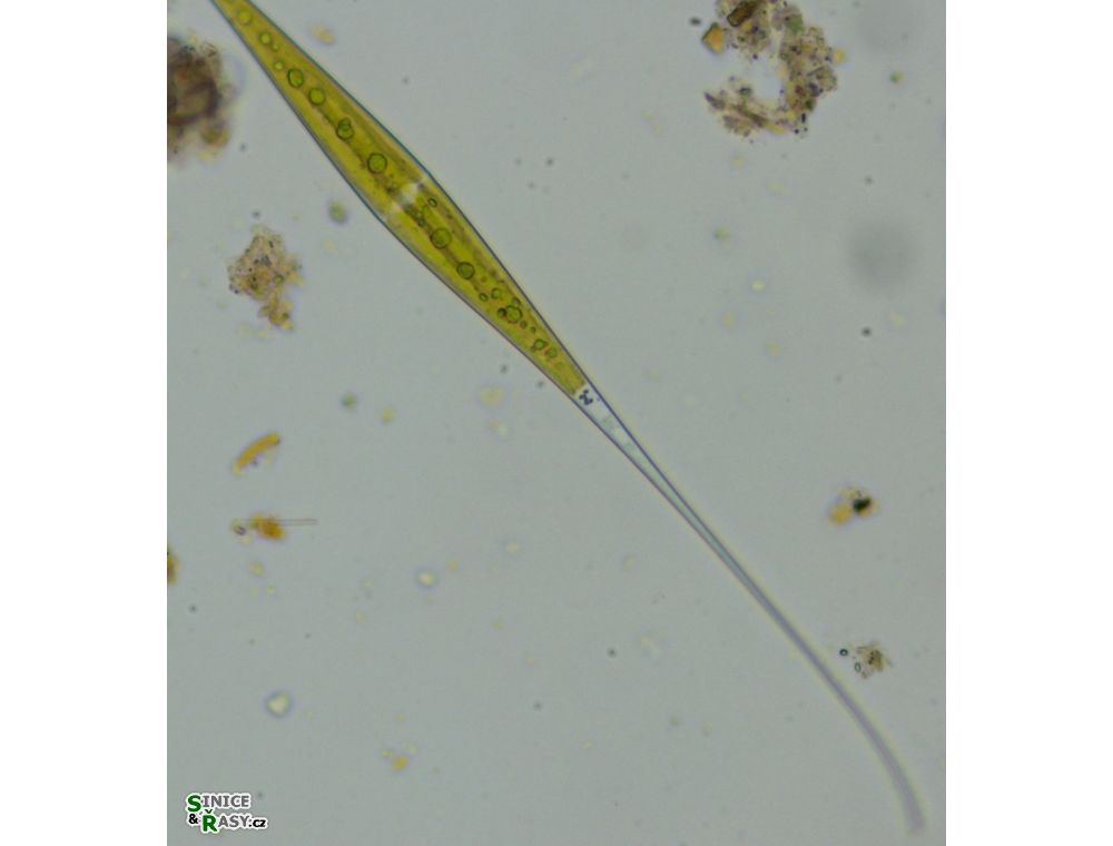 Closterium kuetzingii
