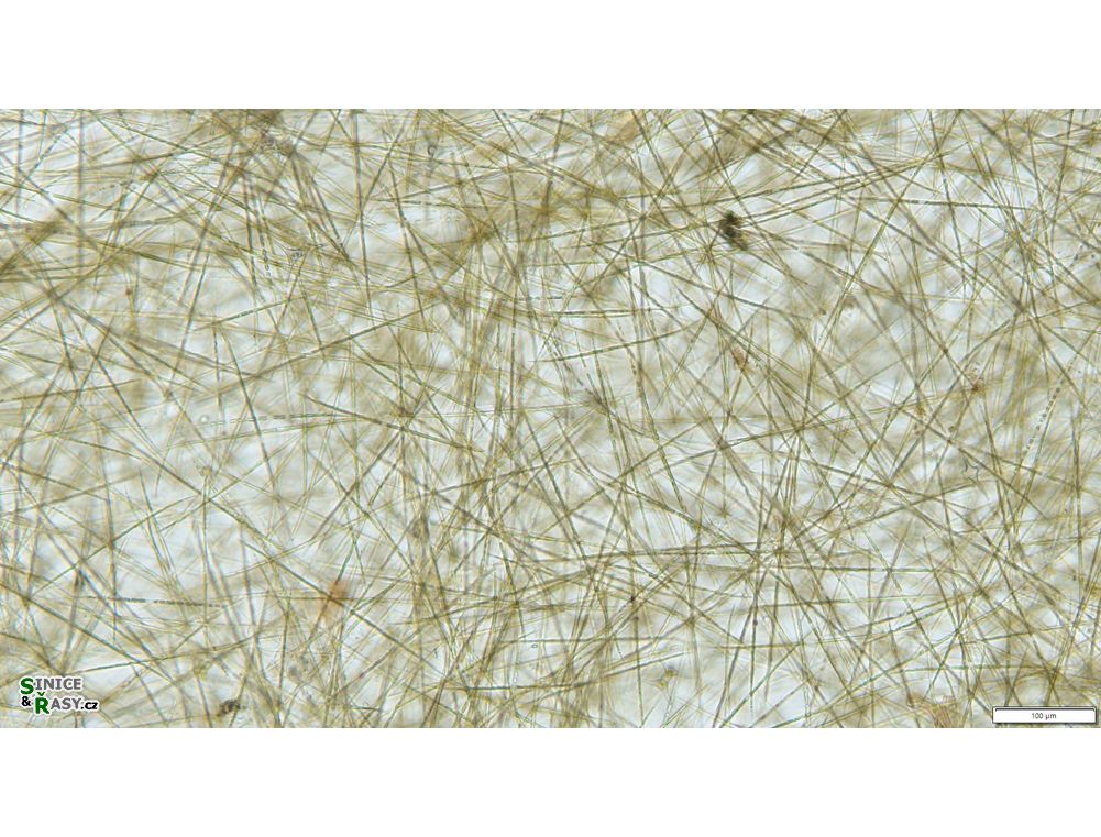 Closterium limneticum