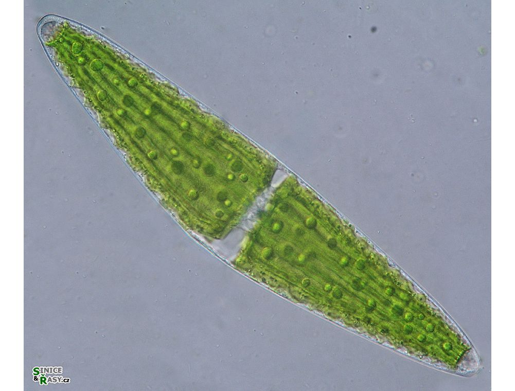Closterium lunula
