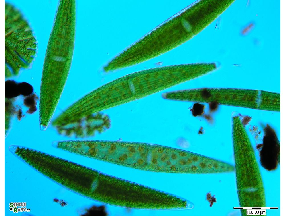 Closterium lunula