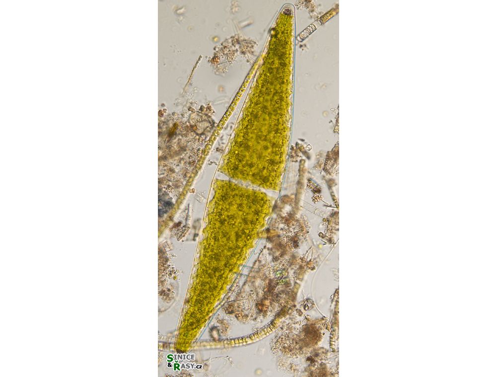 Closterium lunula