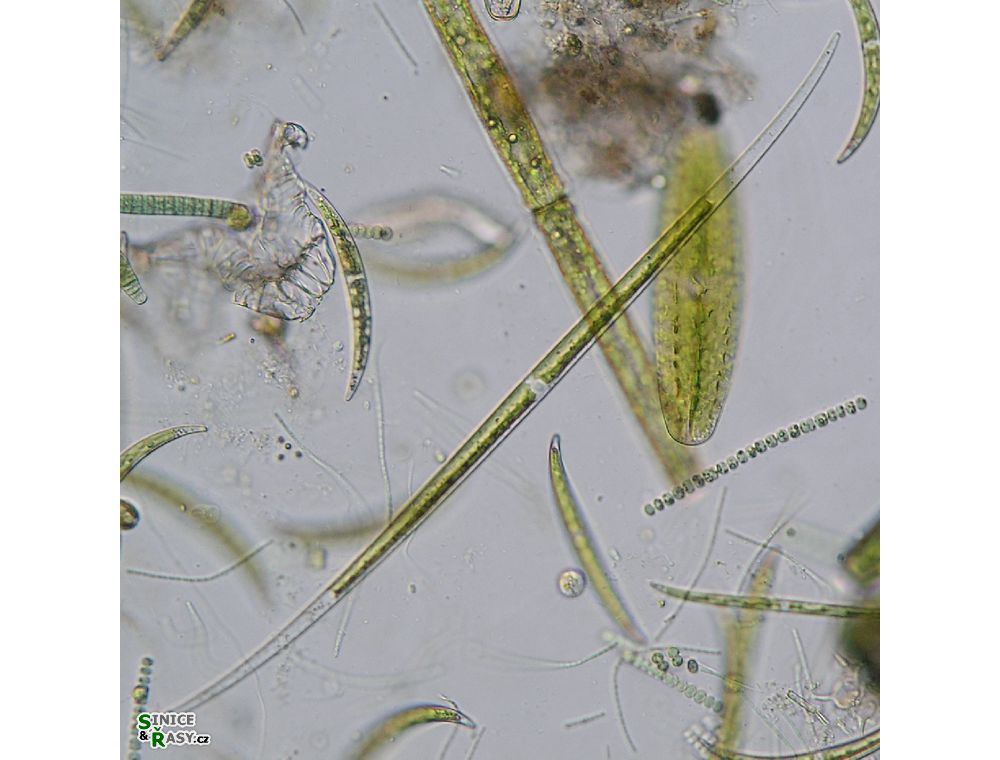 Closterium