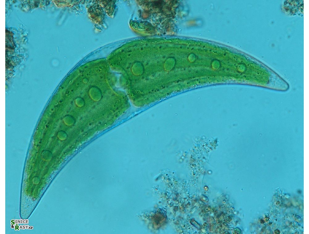 Closterium moniliferum