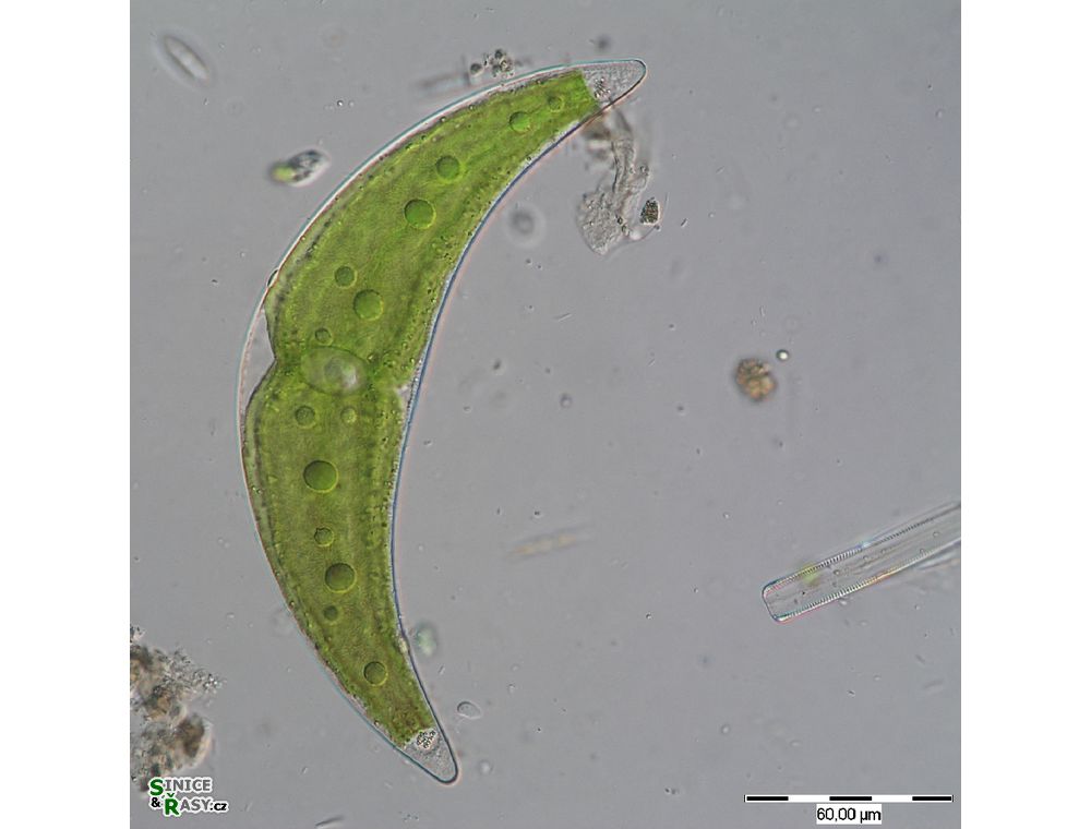 Closterium moniliferum