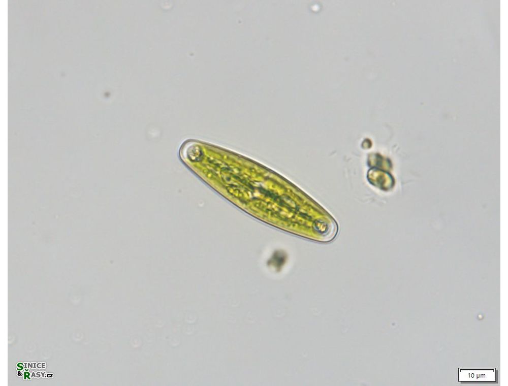 Closterium navicula