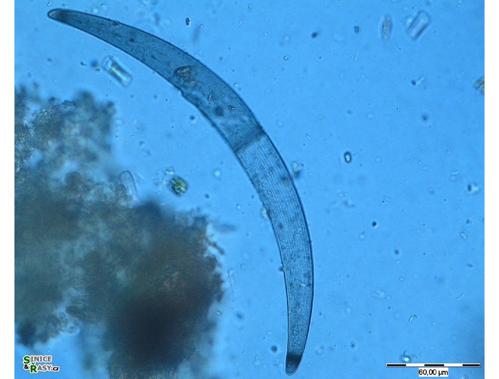 Closterium nematodes
