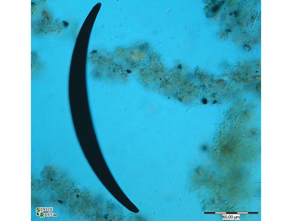 Closterium nematodes