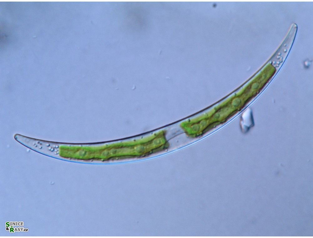 Closterium parvulum