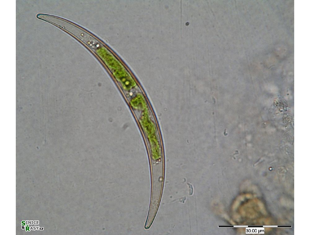 Closterium parvulum