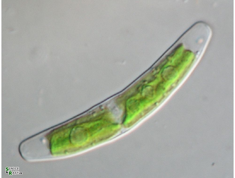 Closterium pusillum