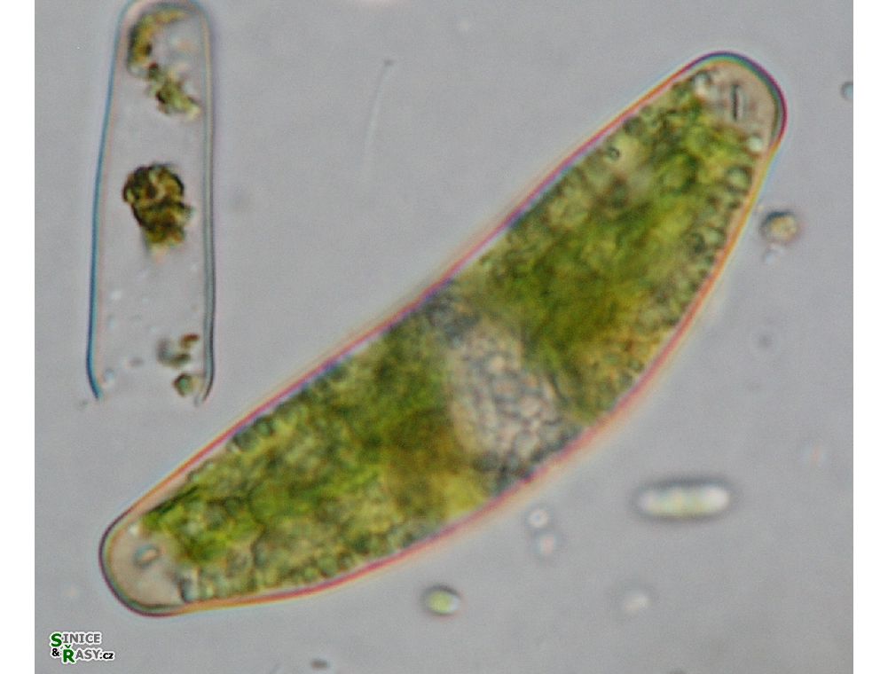 Closterium