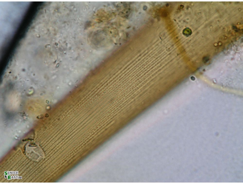 Closterium ralfsii