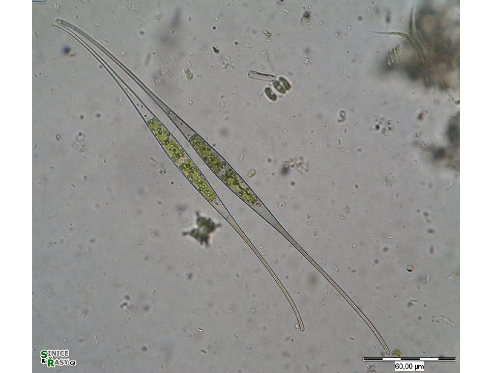 Closterium setaceum