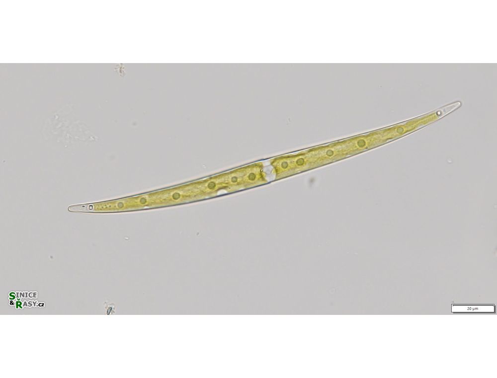 Closterium strigosum