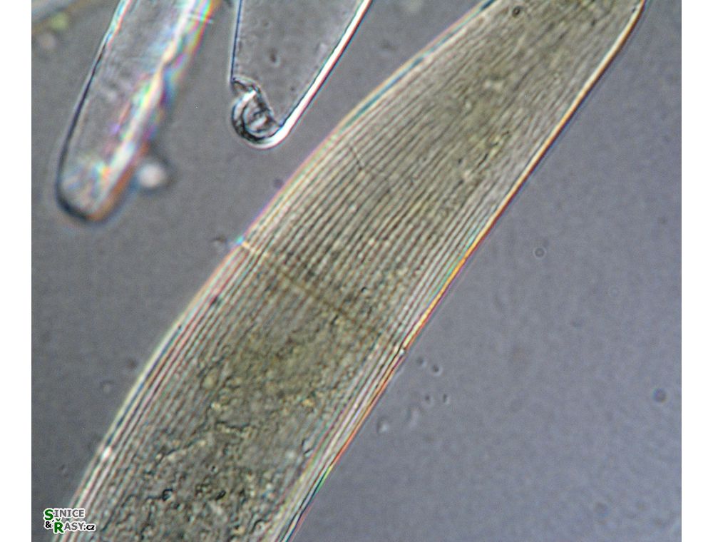 Closterium striolatum