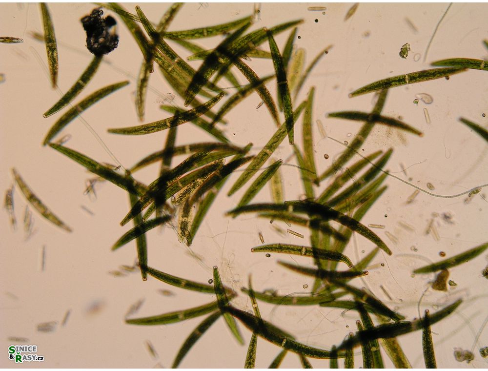 Closterium striolatum