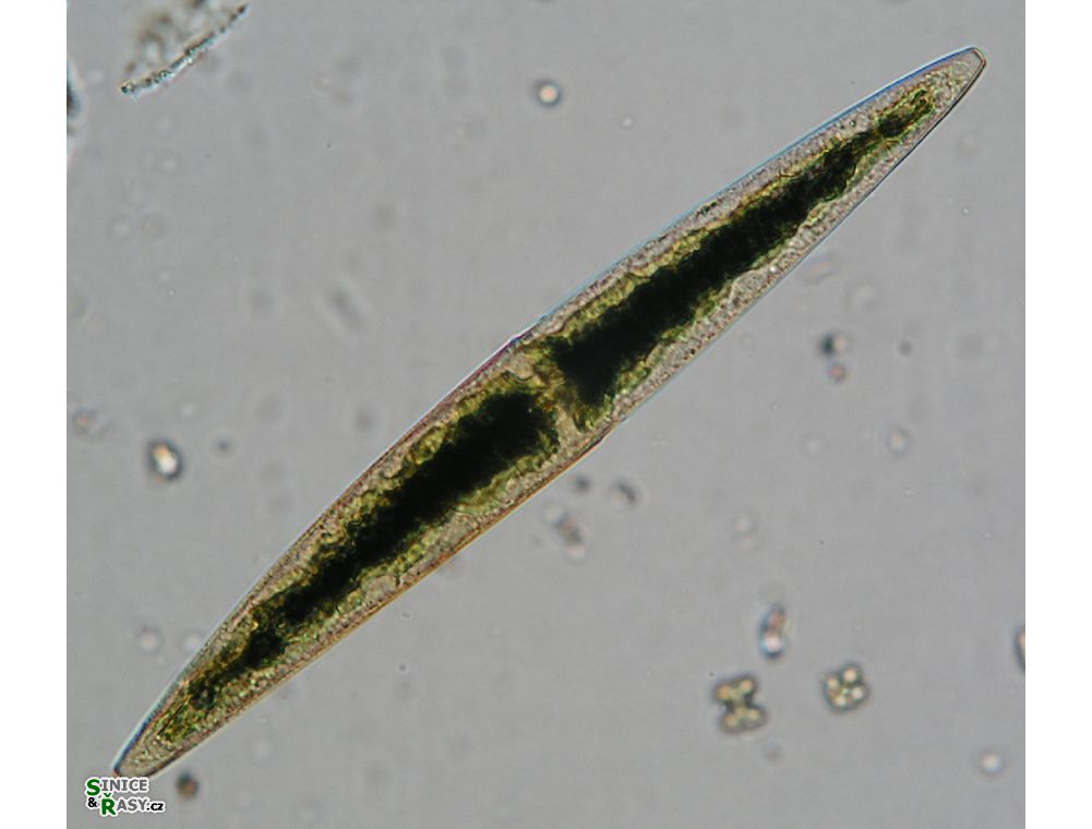 Closterium subfusiforme