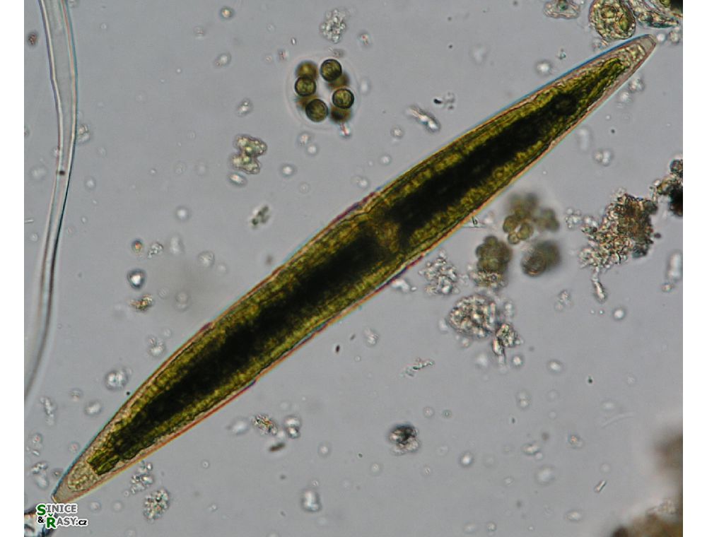 Closterium subfusiforme
